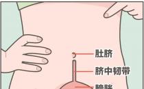 ?肚臍下面疼是怎么回事，肚臍下面疼是怎么回事男性